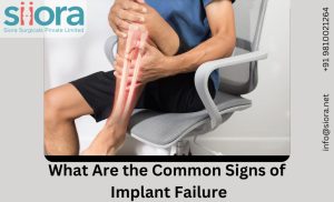 What Are the Common Signs of Implant Failure?